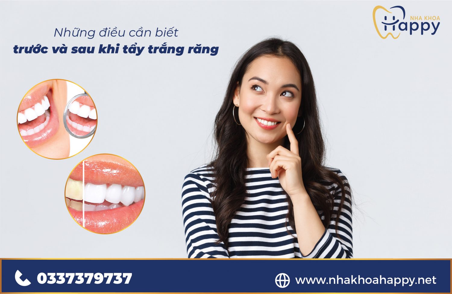 Tẩy trắng răng