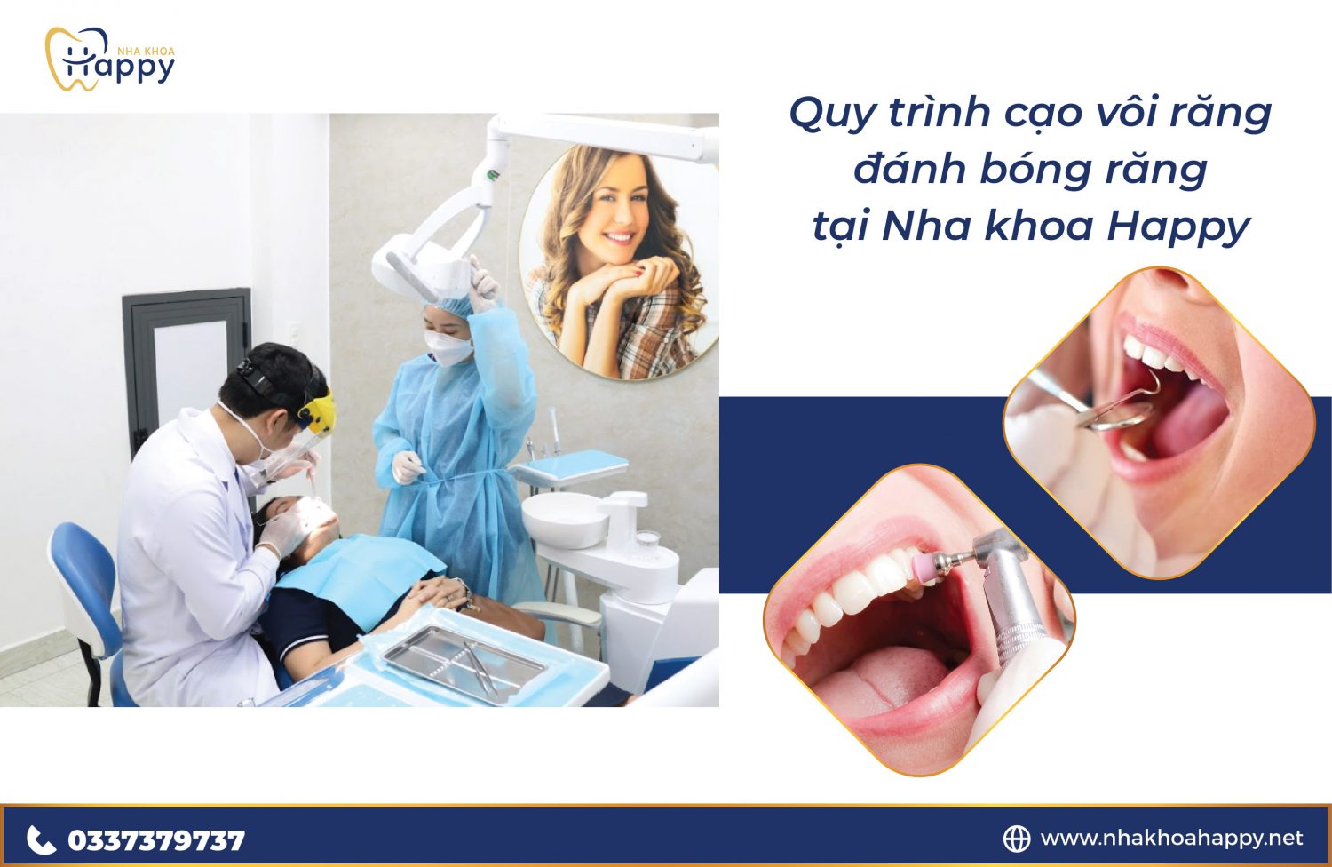 Quy trinh cao voi ran danh bong rang tai Nha khoa Happy 03