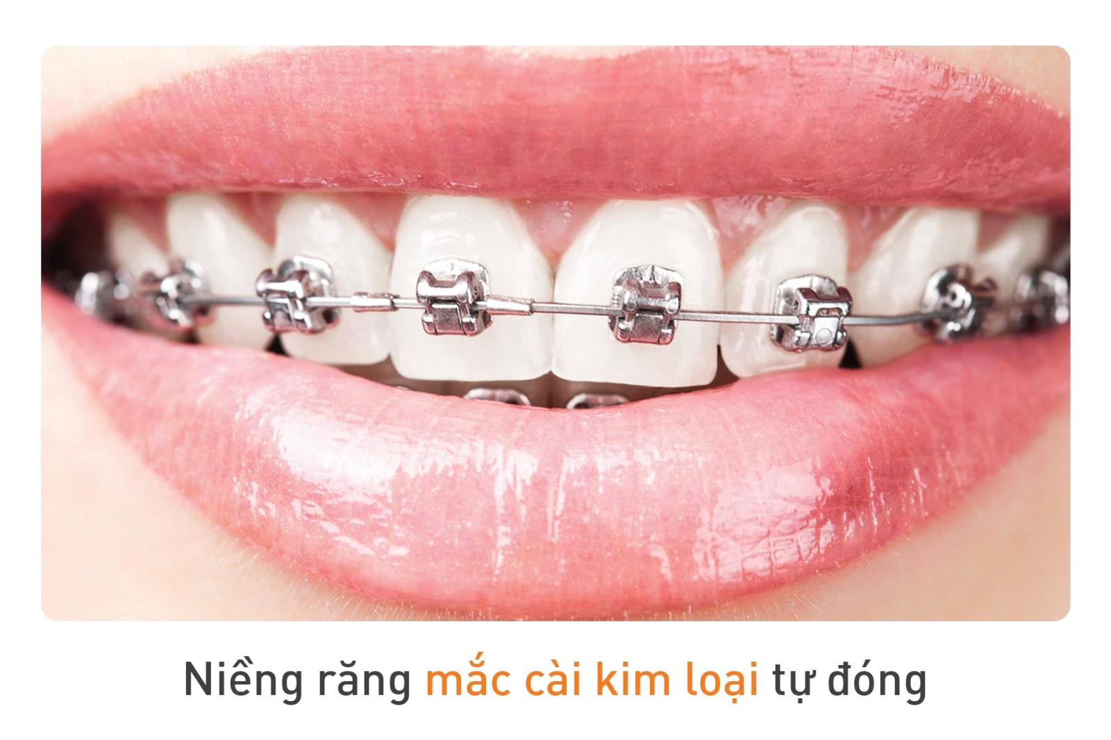 Hình ảnh mắc cài kim loại tự đóng 