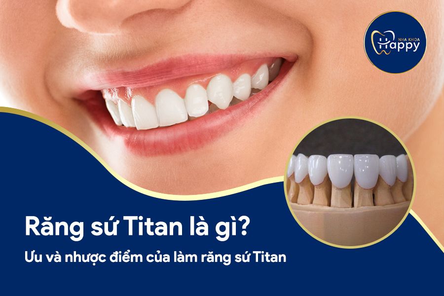 Răng sứ Titan là gì? Ưu và nhược điểm của làm răng sứ Titan