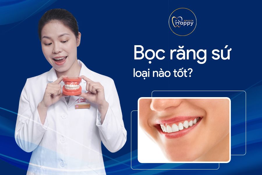 Bọc răng sứ loại nào tốt? Các loại răng sứ tốt nhất hiện nay