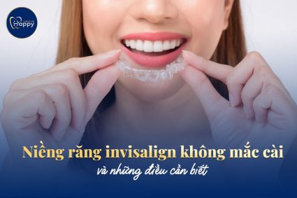 Niềng răng invisalign không mắc cài và những điều cần biết