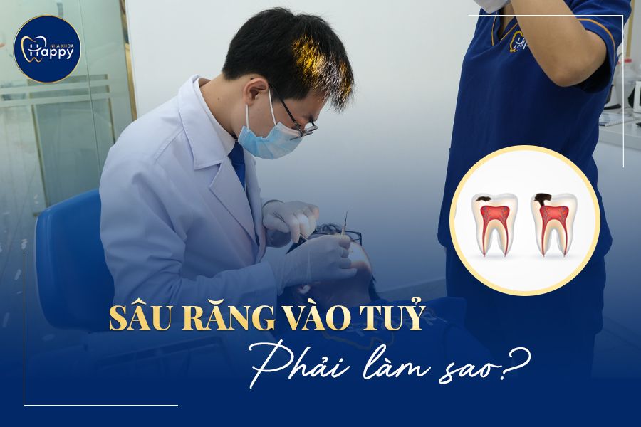 SÂU RĂNG VÀO TỦY PHẢI LÀM SAO? CÁC BIỂU HIỆN VÀ CÁCH ĐIỀU TRỊ