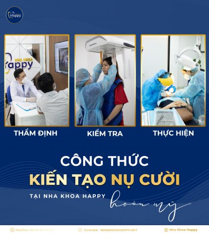 công thức kiểm tra nụ cười tại nha khoa Happy