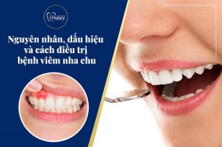 Nguyên nhân, dấu hiệu và cách điều trị bệnh viêm nha chu