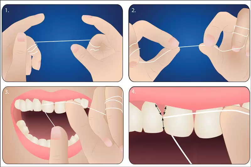 Các bước dùng chỉ nha khoa 