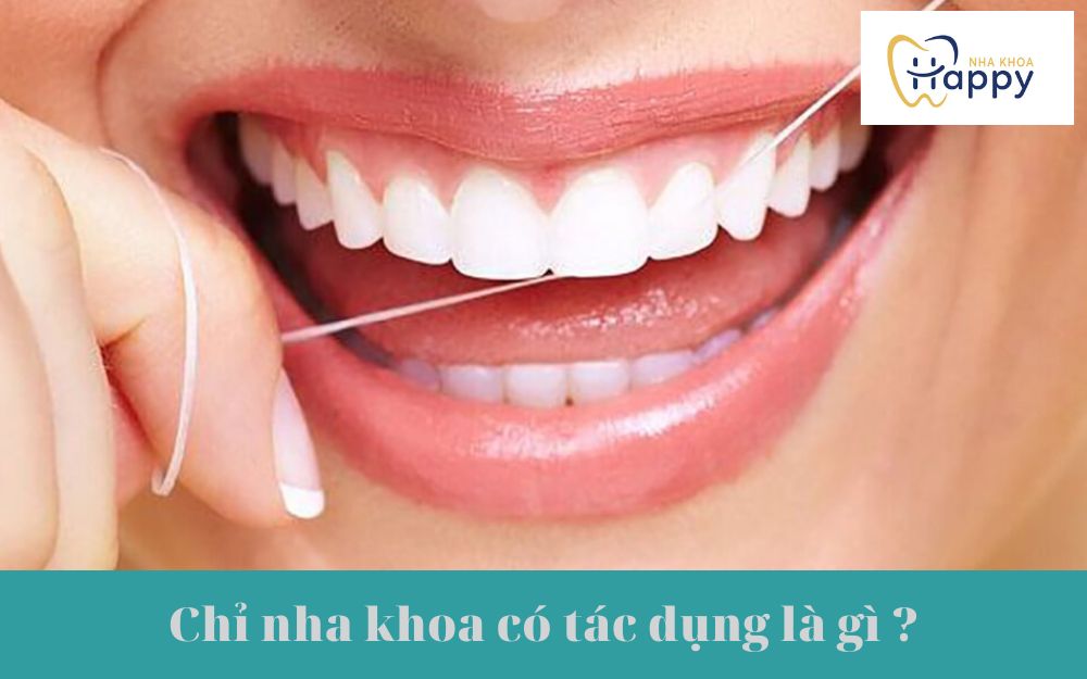 chỉ nha khoa có tác dụng là gì ? 