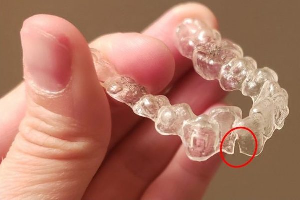 khay niềng răng trong suốt Invisalign