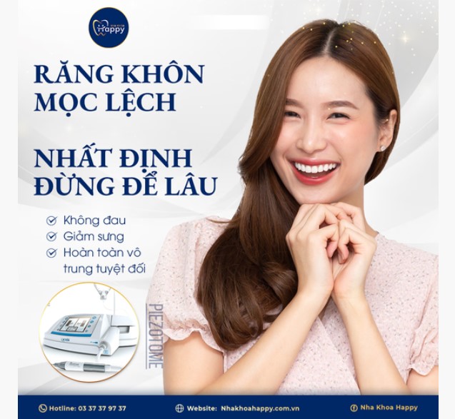 nhổ răng khôn bằng máy Pieztome