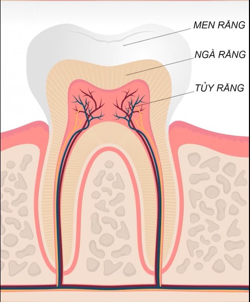 răng bị viêm tủy 