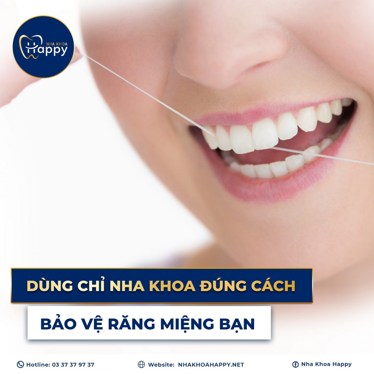 chỉ nha khoa và cách dùng