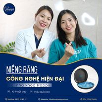 Bảng giá niềng răng nha khoa Bình Dương